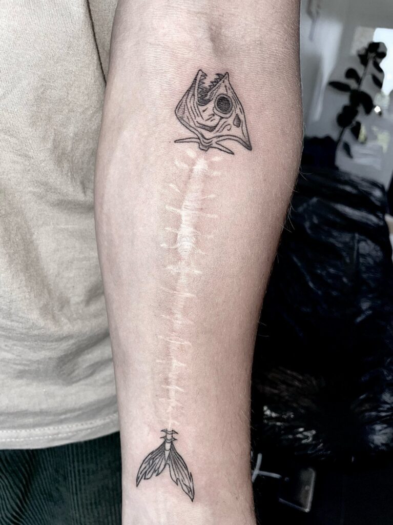 Fish skeleton tattoos on an arm, framing a long surgical scar.
