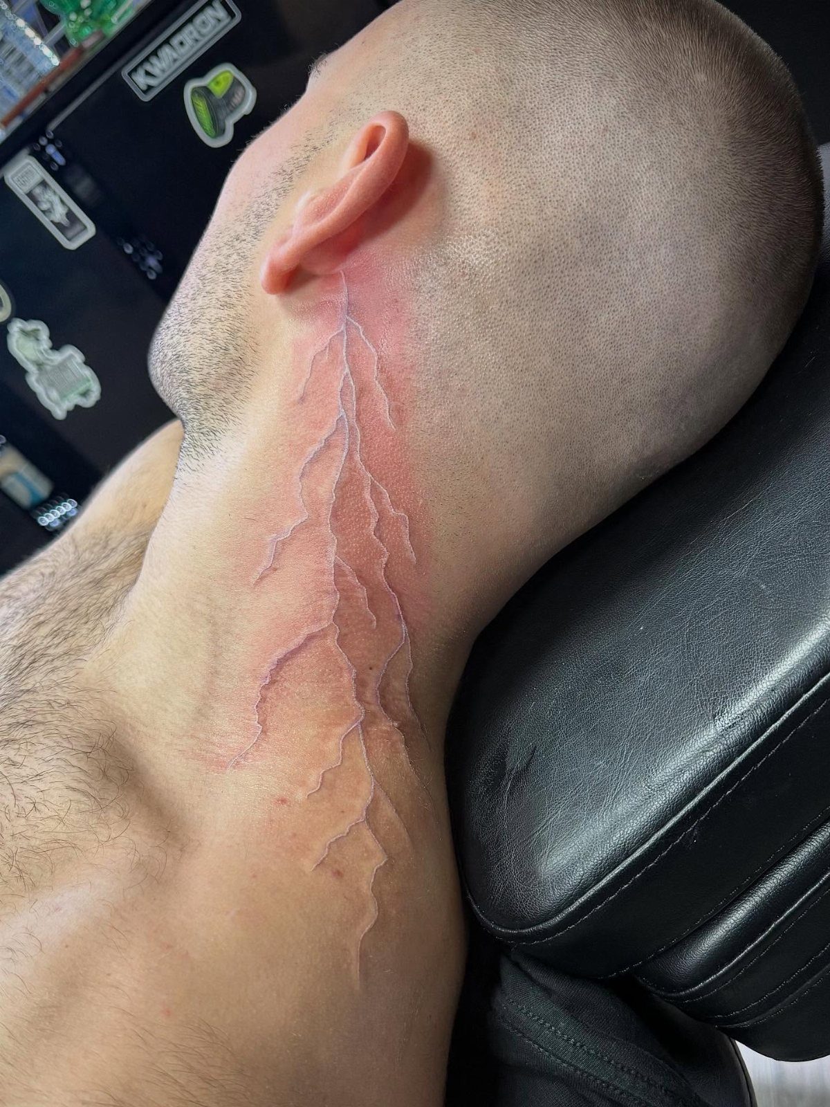 White lightning bolt tattoo on the side of a man's neck.